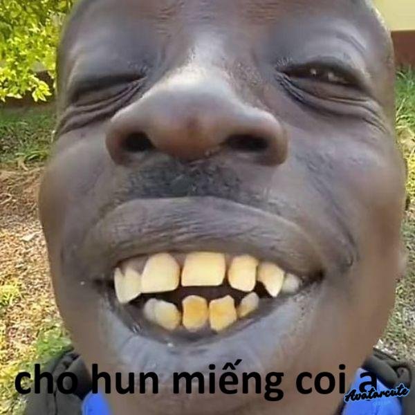 ảnh hôn troll răng thưa